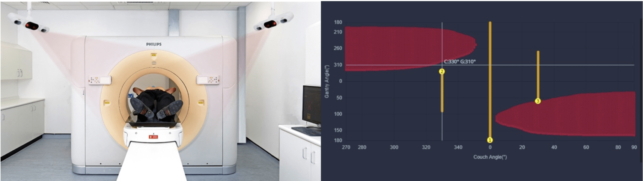 Vision RT launches MapRT at ESTRO 2023 - Vision RT