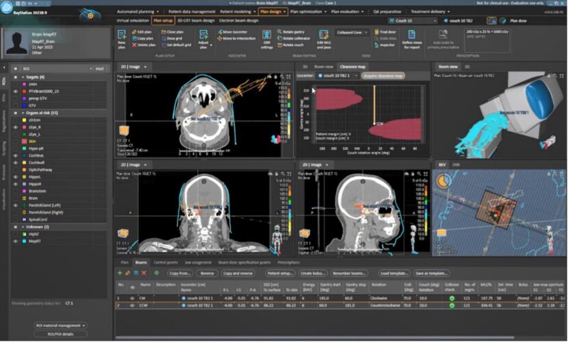 RaySearch and Vision RT unveil automated RayStation®-MapRT® integration