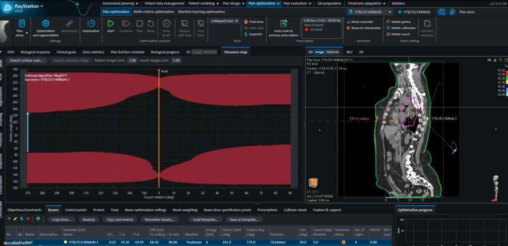 Multi Isocenter Example | Raigmore Hospital