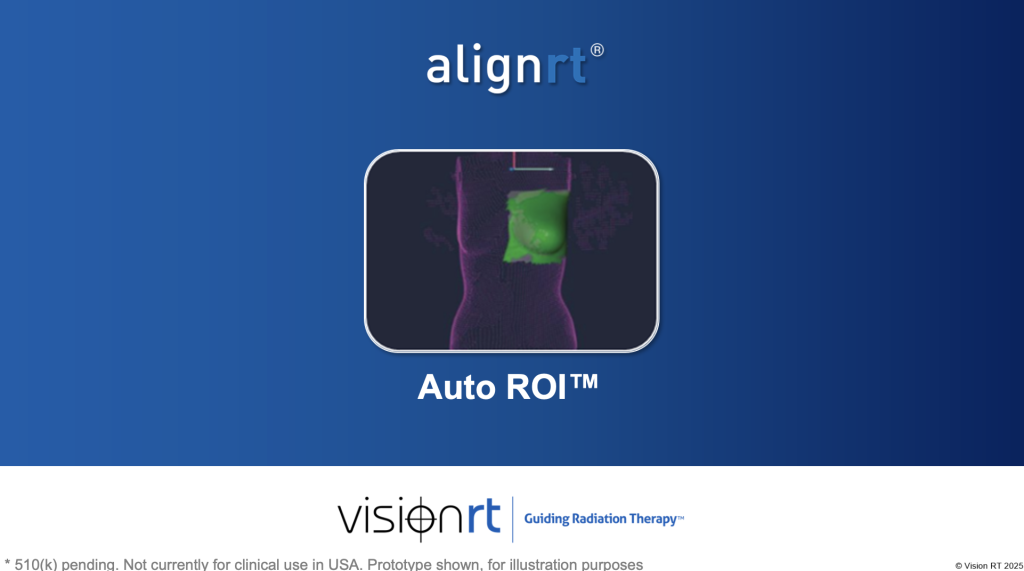 Auto ROI